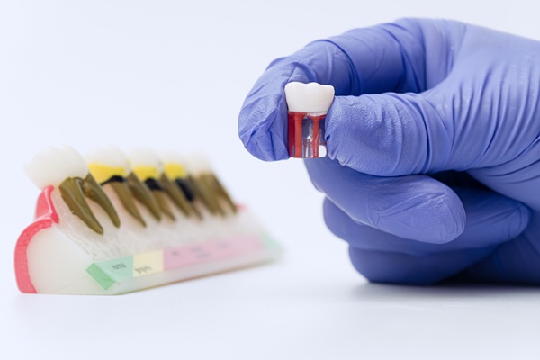 Dental Crown Vs Filling: Which Is The Better Option?
