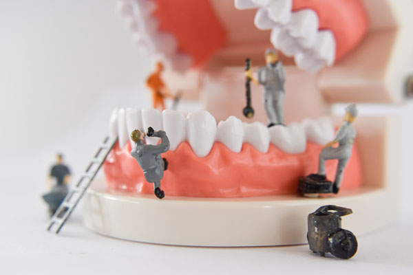 Denture Repairs &# ; Denture Rebase And Denture Reline