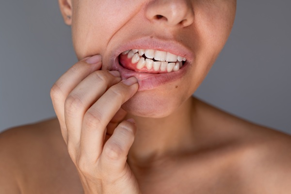 Gum Disease Treatment: Stages, Best Therapies, And How To Prevent Its Return