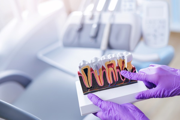 Common Myths About Root Canals, Debunked By Dentists